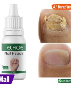 EELHOE Makes Your Nail Clean EELHOE Nail Repair Serum Nail Repair Oil 15ML